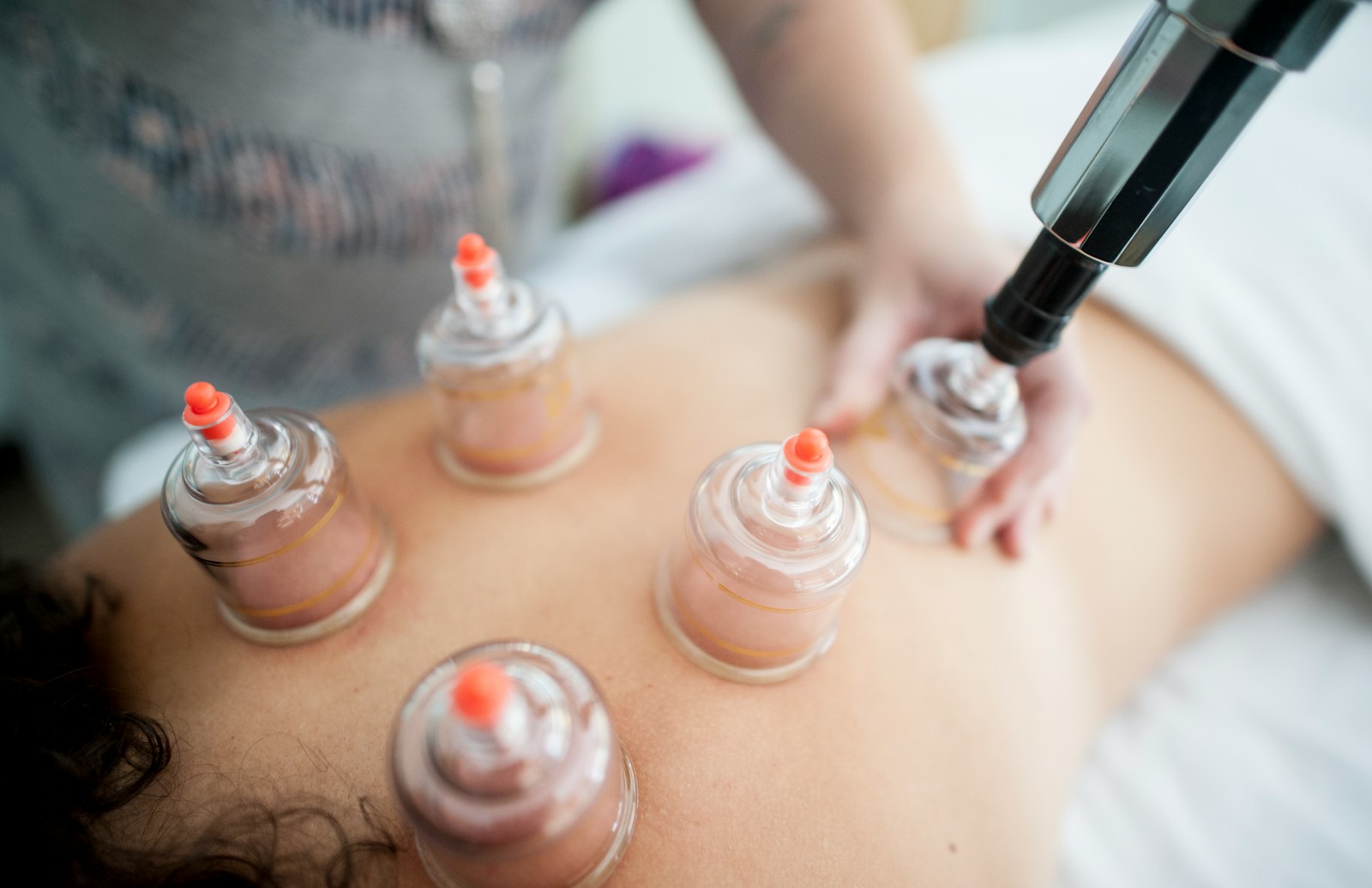 Cupping Therapie in Amsterdam: Verhoog je Bloedcirculatie en Verminder Pijn Vandaag